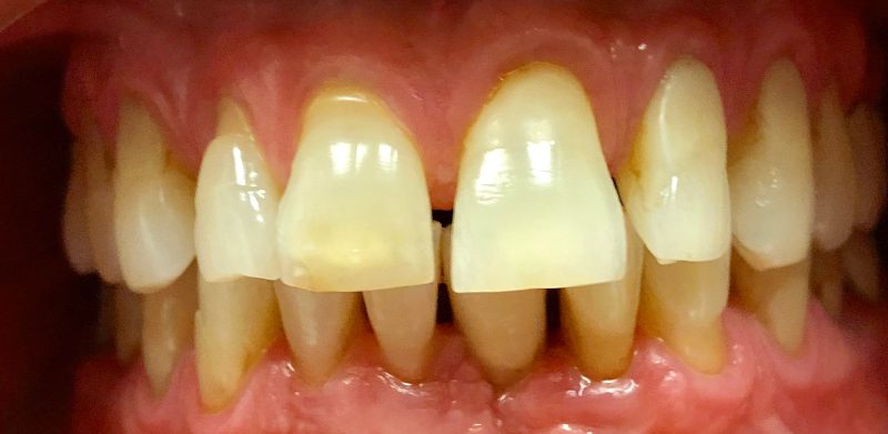 Before Image Before Image