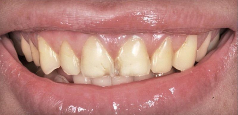 Before Image Before Image