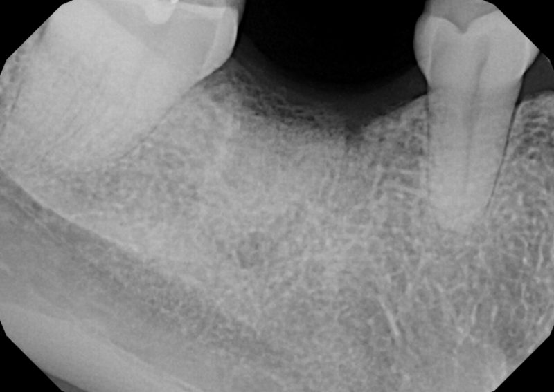 Before Image Before Image